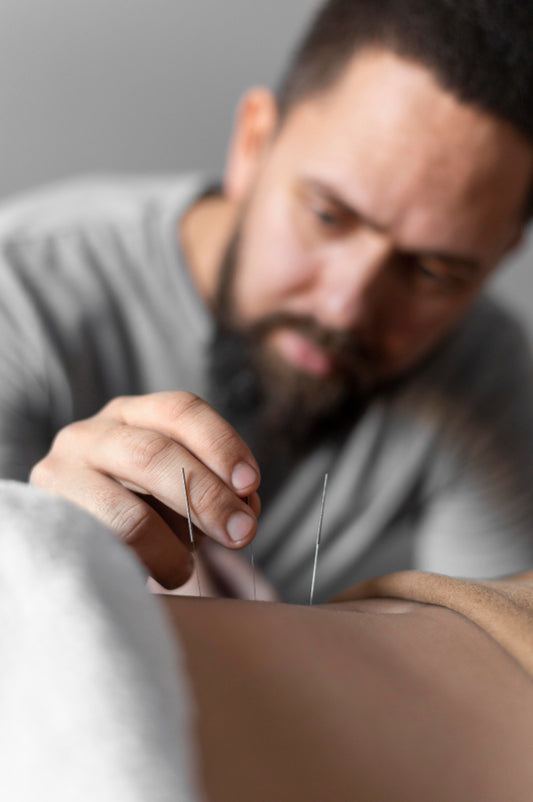 Exploring the Benefits of Acupuncture for Athletes