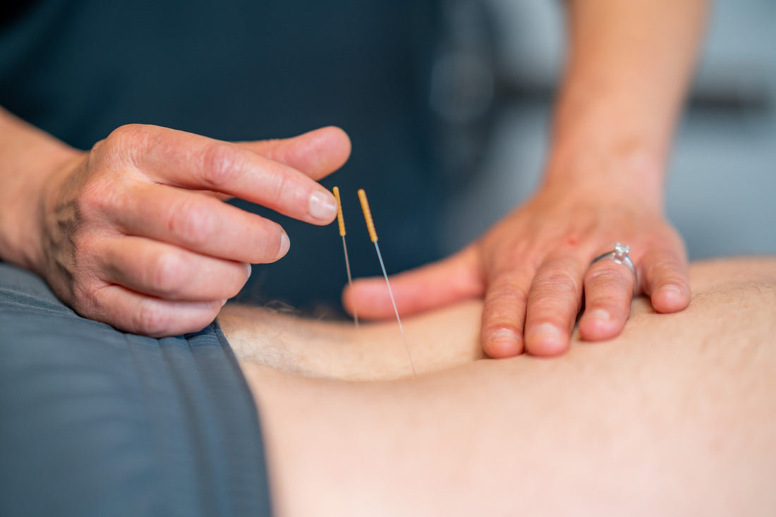 Dry Needling vs. Acupuncture: Which Is Better for Pain Relief?