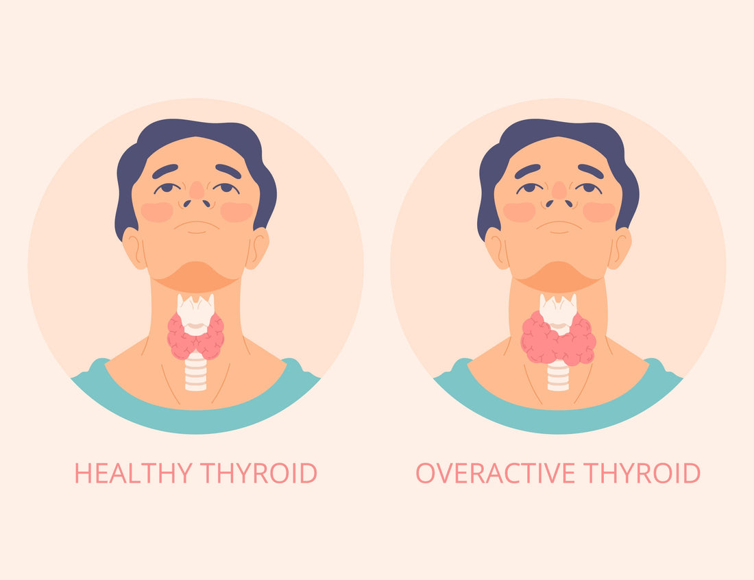 Natural Thyroid Boosting Supplements for Better Hormonal Balance