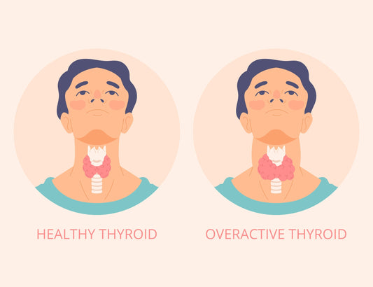 Natural Thyroid Boosting Supplements for Better Hormonal Balance