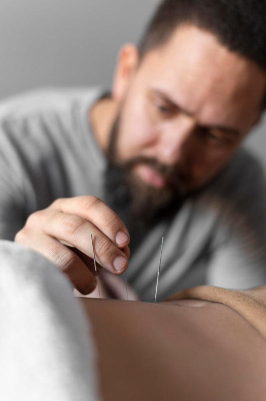 Exploring the Benefits of Acupuncture for Athletes - Fitness Health 