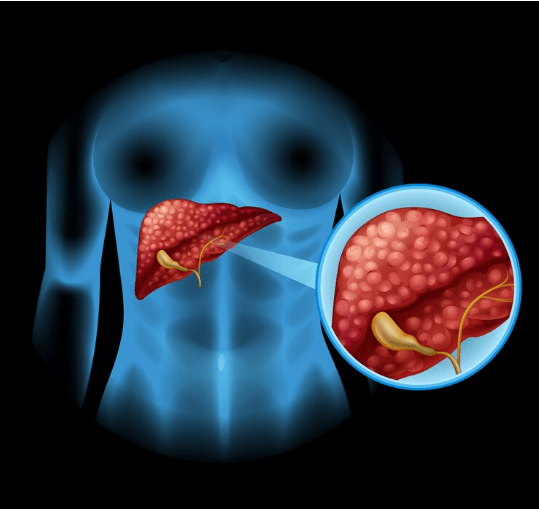 Maximize Your Workouts: Running on Treadmill Calories Burned Explained ...