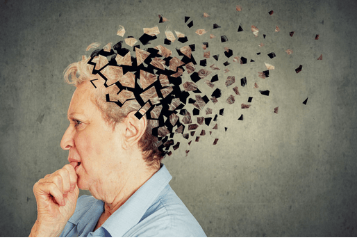 What is Alzheimer disease and what are the symptoms - Fitness Health 